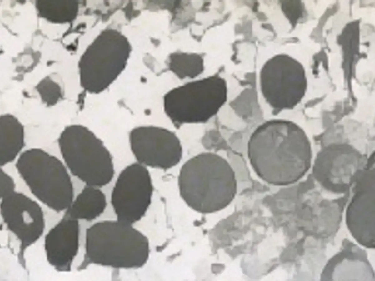 Электронно-микроскопическое изображение показывает зрелые частицы вируса оспы обезьян овальной формы, а также полумесяцы и сферические частицы незрелых вирионов, полученные из клинического образца кожи человека, связанного со вспышкой заболевания прерийных собак в 2003 году, на этом недатированном снимке, полученном агентством Рейтер 18 мая 2022 года. Cynthia S. Goldsmith, Russell Regnery/CDC/Handout via REUTERS ЭТО ИЗОБРАЖЕНИЕ БЫЛО ПРЕДОСТАВЛЕНО ТРЕТЬЕЙ СТОРОНОЙ.
