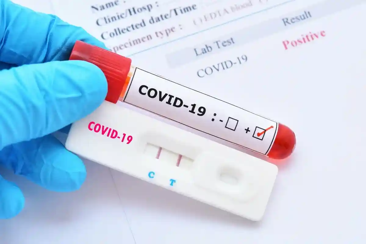 Вполне возможно выяснить долю людей, у которых уже выработались антитела к коронавирусу. Это можно сделать, исследовав образцы крови населения. Фото: Jarun Ontakrai / Shutterstock.com 