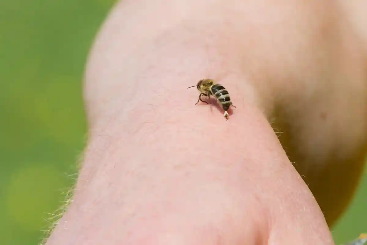 «Ты можешь забыть и проснуться от удушья»: врач раскрыла, когда укус осы приводит к смерти