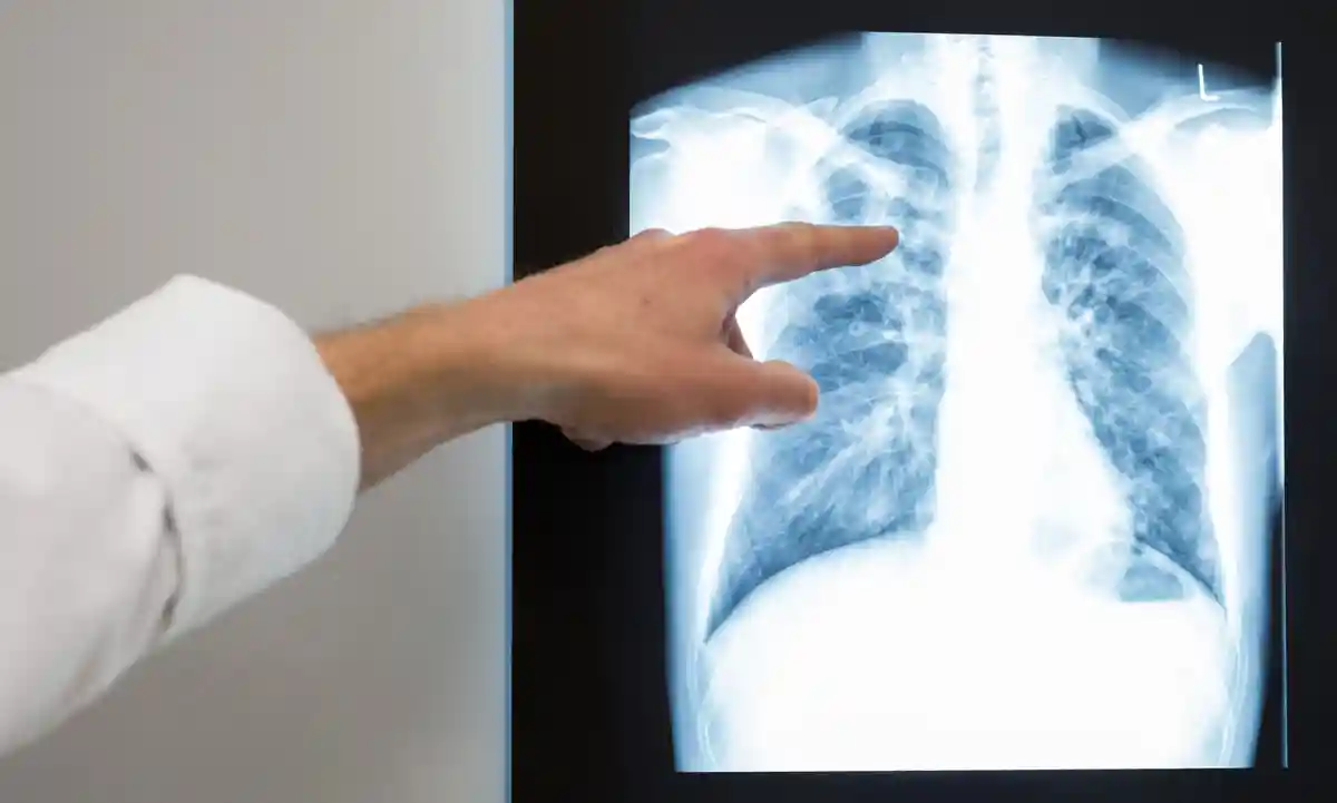 В Хемнице выявлены случаи заболевания туберкулезом